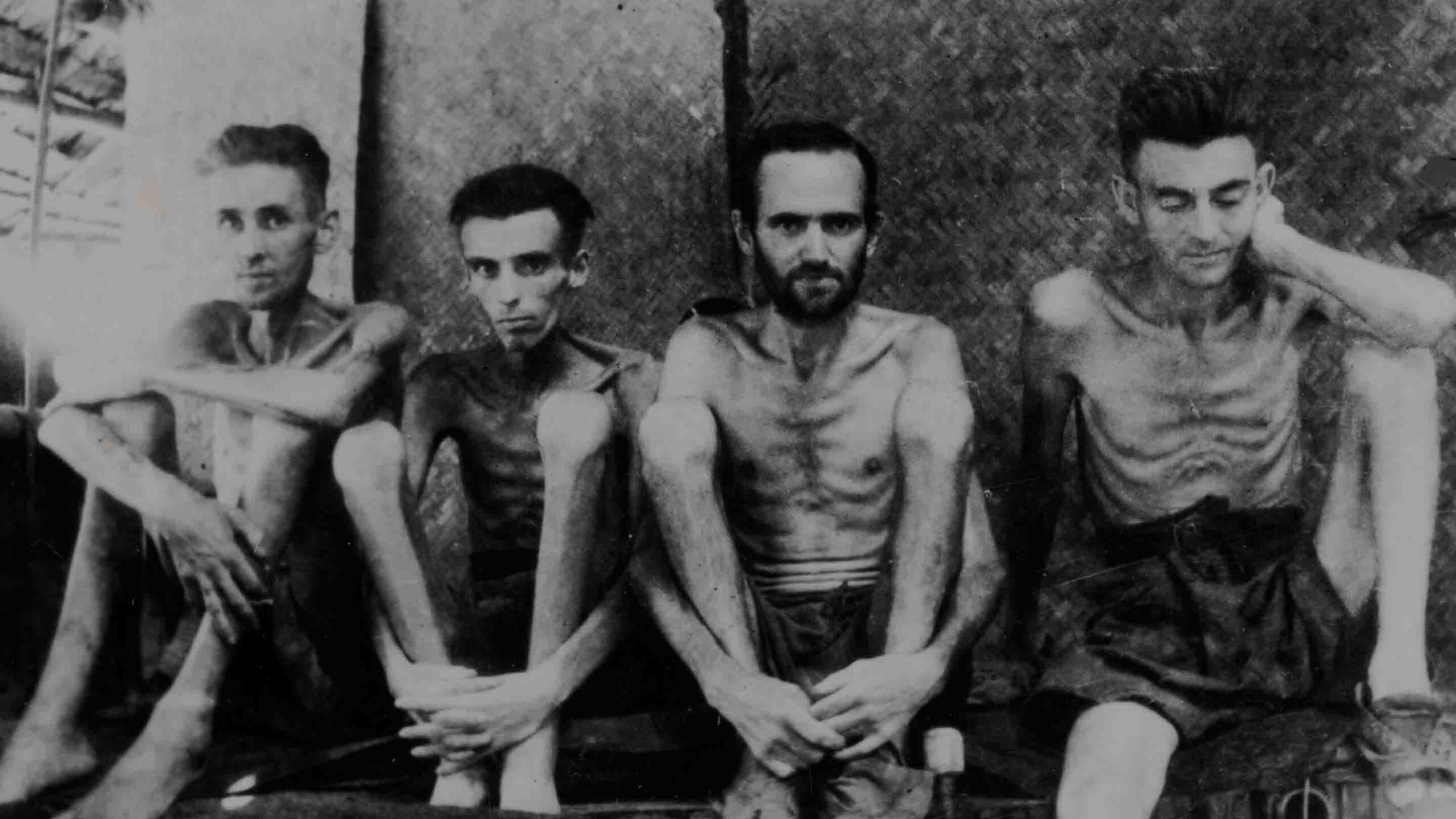 Australian and Dutch prisoners of war suffering from beri beri at Tarsau, Thailand, 1943.